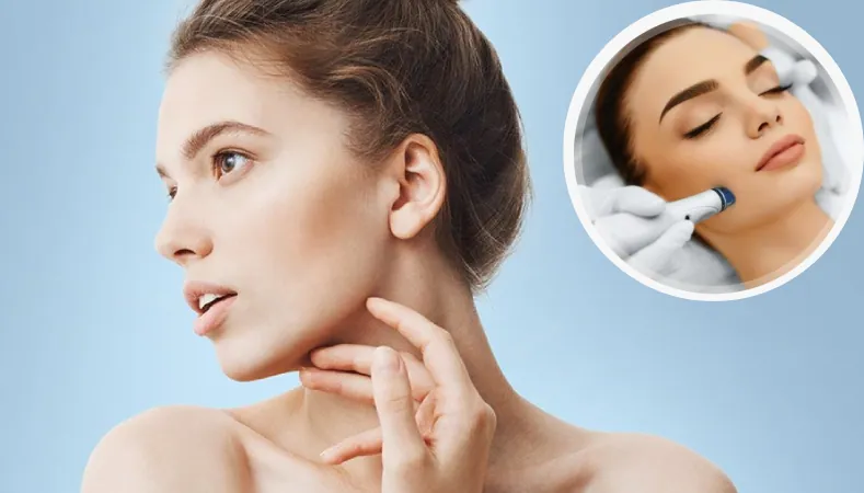 Laser skin treatment (representative image)