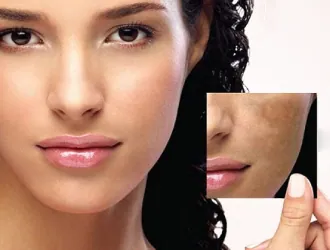 Dermatology (Skin) (representative image)